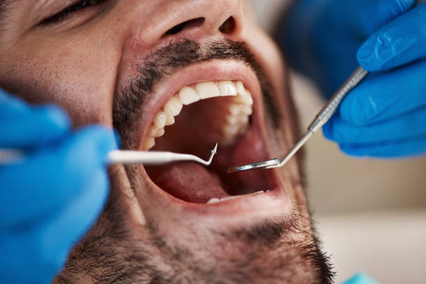 Best Dental Abscess Treatment in Newton, TX